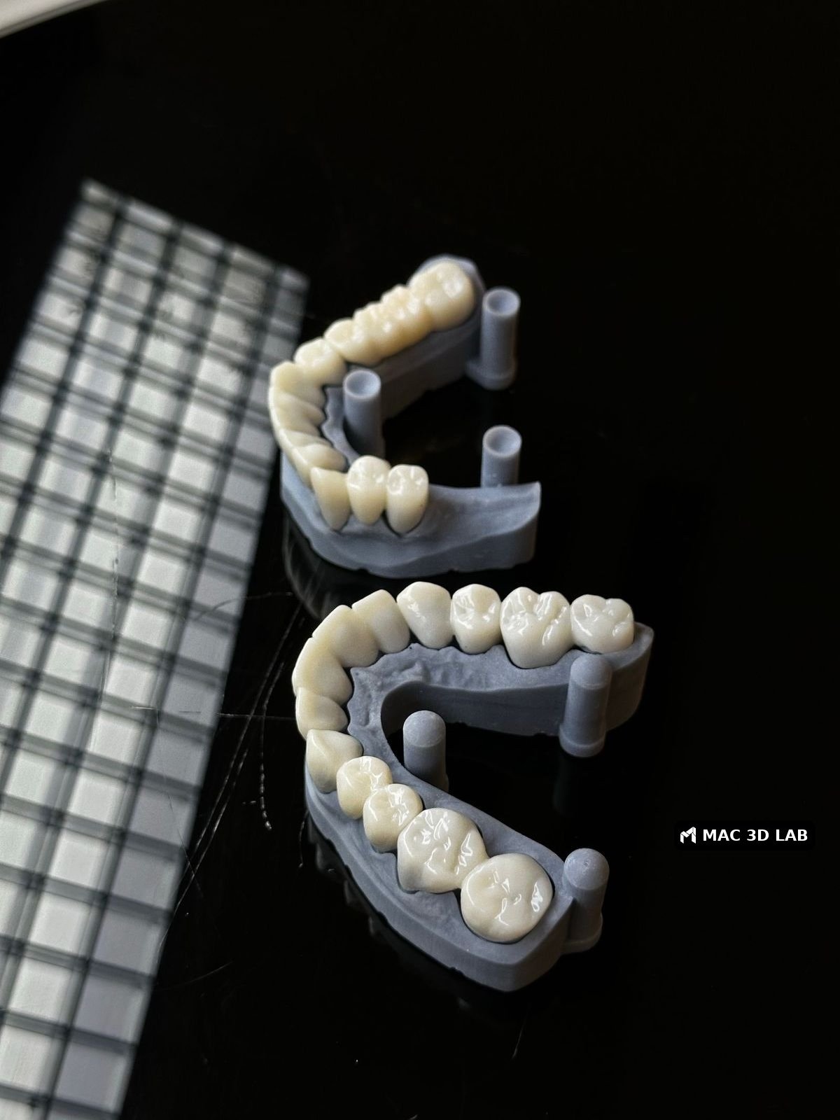 Modelos dentales impresos en 3D